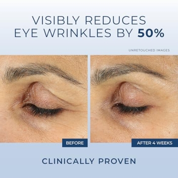 RoC Retinol Eye Cream for Dark Circles & Wrinkles - Mini Size