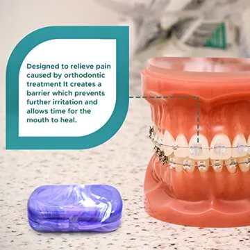 Orthodontic Dental Wax for Braces – Premium Braces Wax in Designer Marble Cases, Tooth Wax for Braces, Clear & Unscented, 6-Pack Assorted Colors