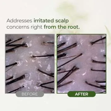 STEAMBASE Tea Tree Scalp Treatment | Purifies and Exfoliates Oily Scalp | Natural BHA & Tea Tree | Removes Odor & Buildup | Hypoallergenic Exfoliator, 8.42 fl oz