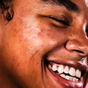 Starface Hydro-Star Clear Big Pack Pimple Patches - Clear & Effective