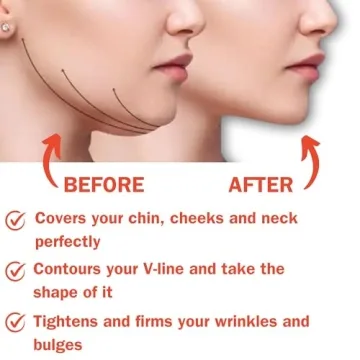 Post Surgical Chin Strap for Neck and Chin Compression