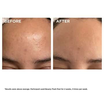 Clarins Beauty Flash Peel | Renew Your Radiance in 10 Minutes