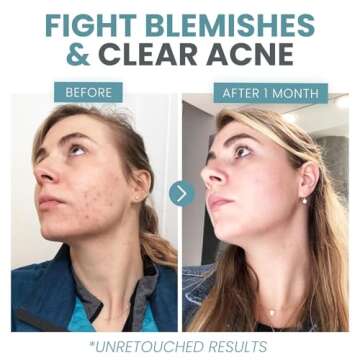 Vitamin C Serum | Anti-Aging, Brightening, Skin Clearing 2 oz