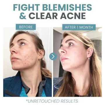 Vitamin C Serum | Anti-Aging, Brightening, Skin Clearing 2 oz