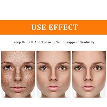 Hydrating Turmeric Dark Spot Corrector Toner for Acne-Prone Skin, 4 oz