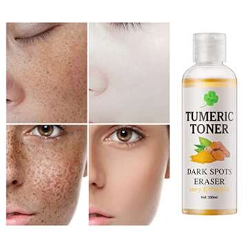 Toner for Dark Spots - Hydrating Facial Toner for All