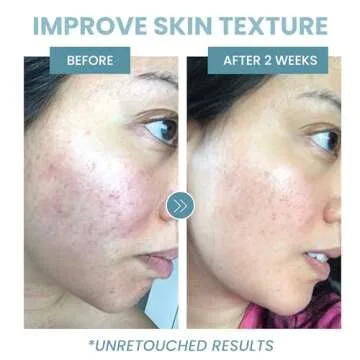 Collagen Peptide Serum - Anti Aging Collagen Serum for Face, Skin Brightening, Reduces Fine Lines & Wrinkles, Heals and Repairs Skin, Microneedling Serum with Hyaluronic Acid (2 oz)