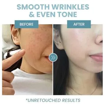 Collagen Peptide Serum - Anti Aging Collagen Serum for Face, Skin Brightening, Reduces Fine Lines & Wrinkles, Heals and Repairs Skin, Microneedling Serum with Hyaluronic Acid (2 oz)