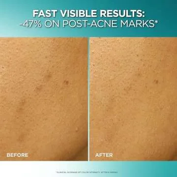 L'Oreal Bright Reveal Dark Spot Exfoliant Peel Solution