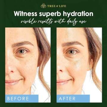 Tree of Life Beauty Hyaluronic Acid Serum, Skin Brightening Face Oil for Dark and Age Spots, Facial Serums for Dry and Sensitive Skin Care with Vitamin E for Soft Smooth Skin, 2 Fl Oz