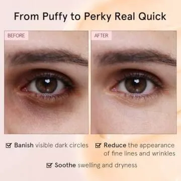 Grace & Stella Under Eye Cream - Caffeine Anti Aging & Brightening - Dark Circles, Wrinkles, Puffiness & Bags - Made in USA, Vegan (0.46 oz/13 g)