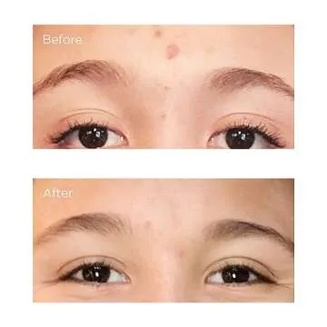 Perricone MD Acne Relief Prebiotic Acne Therapy