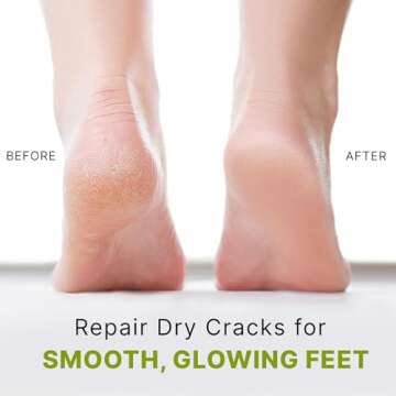 Pumice Stone for Feet - Natural Lava Stone Foot Exfoliator, Callus Remove for Feet, Hands & Dead Skin, Foot Scrubber for Pedicure & Cracked Heels, Strong & Durable Design for Smooth & Soft Feets