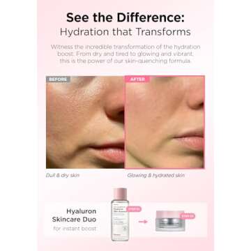 Hanskin Real Complexion Hyaluronic Skin Essence, Hydrating Toner for Dry, Dull, Sensitive Skin - Hyaluronic Acid Collagen Moisturizing Purifying Paraben-Free Korean Skincare for Face [5.07 fl. oz.]