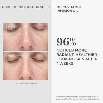 Murad Multi-Vitamin Infusion Facial Oil - Hydrating Anti-Aging Oil