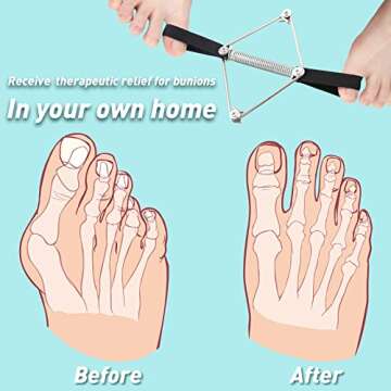 Pilates Toe Stretcher Bunion for Pain Relief and Flexibility