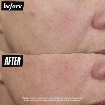 Kiehl's Auto-Tone Discoloration & UV Solution with SPF 30