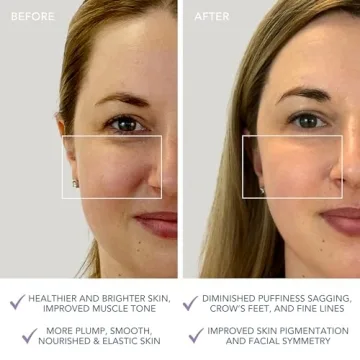 FOREO BEAR Mini Microcurrent Facial Device Firm & Contour