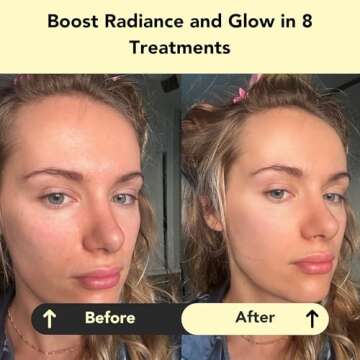 Glorio GLOW: 8 Revitalizing Clay Face Mask Treatments for Radiance