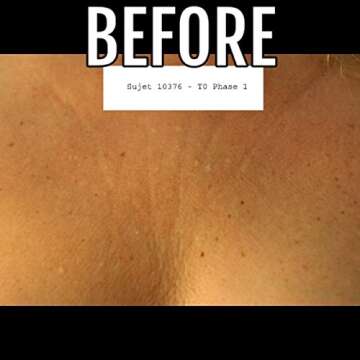 La Decollette Anti Wrinkle Night Bra for Women