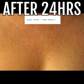 La Decollette Anti Wrinkle Night Bra for Women