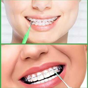 Zopeal 250-Piece Braces Flossers & Interdental Brushes