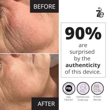 7E Wellness MyoLift Mini Microcurrent Facial Device - Non-Invasive Face Lift, Facial Skin Care Products for Anti Aging, Skin Tightening - Esthetician Supplies and Skin Care Tools - Up to 400 Microamps