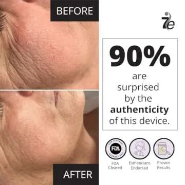 MyoLift Mini Microcurrent Device for Non-Invasive Facelifts