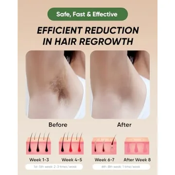 XSOUL At-Home IPL Hair Removal Device for Smooth Skin