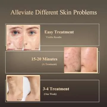 MEGELIN LED Light Therapy Face & Neck Mask - 7 Colors