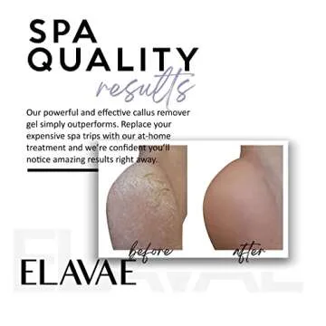 ELAVAE Callus Remover Gel for Smooth, Soft Feet