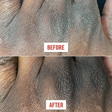 First Aid Beauty Ultra Repair Cream for Dry Sensitive Skin