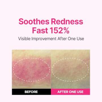 ISOI Blemish Care Serum for Radiant Vegan Skin