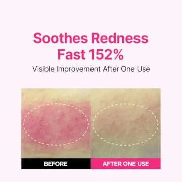 ISOI Blemish Care Serum for Radiant Vegan Skin