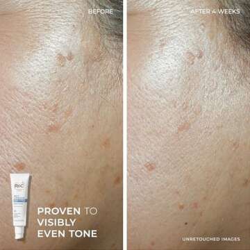 Roc Multi Correxion 5 In 1 Daily Anti-Aging Moisturizer with Restoring Facial Night Cream