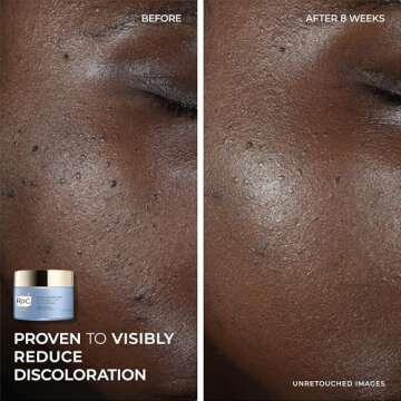 Roc Multi Correxion 5 In 1 Daily Anti-Aging Moisturizer with Restoring Facial Night Cream