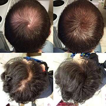 Nor1 Keratin Hair Building Fibers: Natural Instant Hair Filler and Thickener for Men and Women - Com...