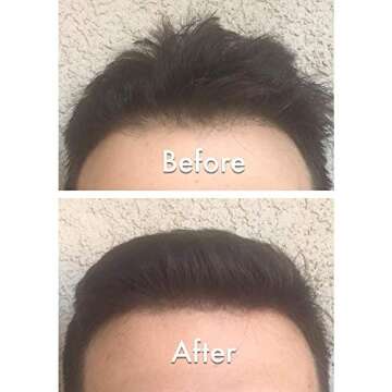 Nor1 Keratin Hair Building Fibers: Natural Instant Hair Filler and Thickener for Men and Women - Completely Cover Up and Conceal Thinning Areas or Bald Spot - 25 grams