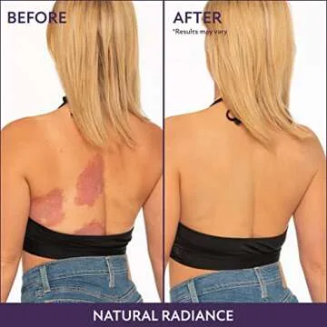 Westmore Beauty Body Coverage Perfector – Waterproof Leg & Body Makeup - Tattoo Cover Up Makeup - 7 Oz (Golden Radiance)