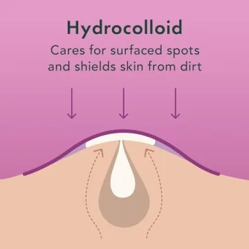 Rael Pimple Patches – Overnight Acne Spot Treatment