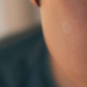 Cover Dot Acne Care Hydrocolloid Treatment 24 Dots