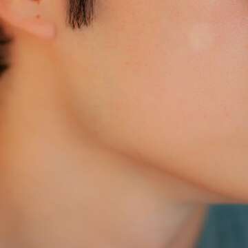 Cover Dot Acne Care Hydrocolloid Treatment 24 Dots