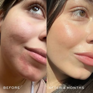 DIME Beauty Blue Facial Oil for Clear Skin and Hydration