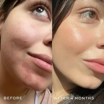 DIME Beauty Blue Facial Oil for Clear Skin and Hydration