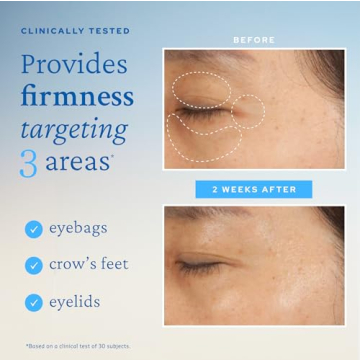 belif Eye Cream Hydrates Firms Reduces Fine Lines