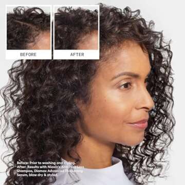 Nioxin Hair Fall Defense Shampoo | Activates Hair Follicles for Visibly Less Hair Loss| With Lauric Acid, Caffeine, Niacinamide and Sandalore| 16 Fl Oz