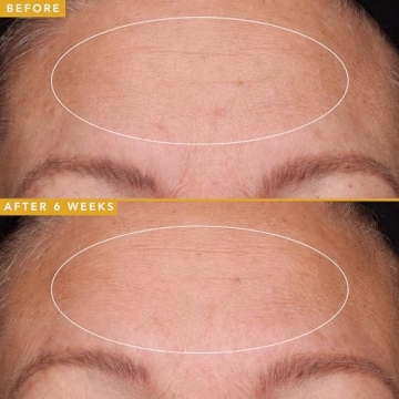 Farmacy Hyaluronic Acid Serum for Youthful Complexion