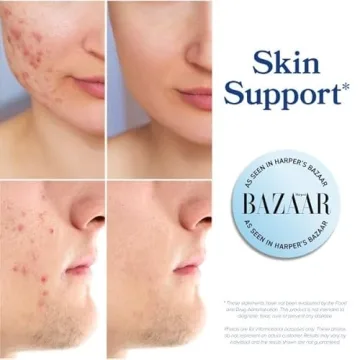 DIM Supplement for Hormonal Balance & Well-being | Vegan & Non-GMO