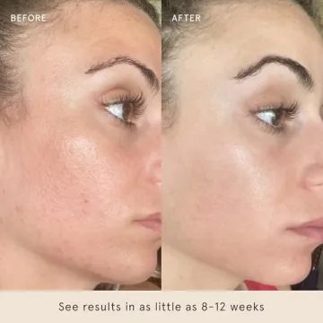 Barefaced Toning Pads - Exfoliating Face Pads for Glowing Skin