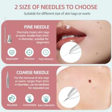 AL-40 Skin Removal Kit, Design to Smooth Your Skin, Safe and Effective for Home Use, Easy to Use Skin Tag Remover Kit